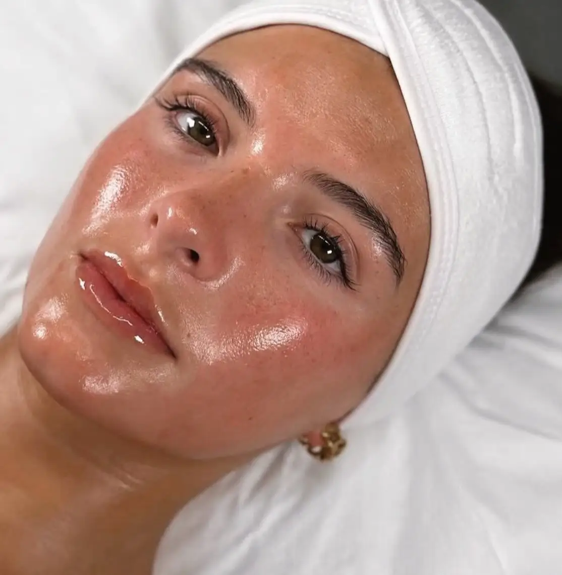Service: Facial Treatments