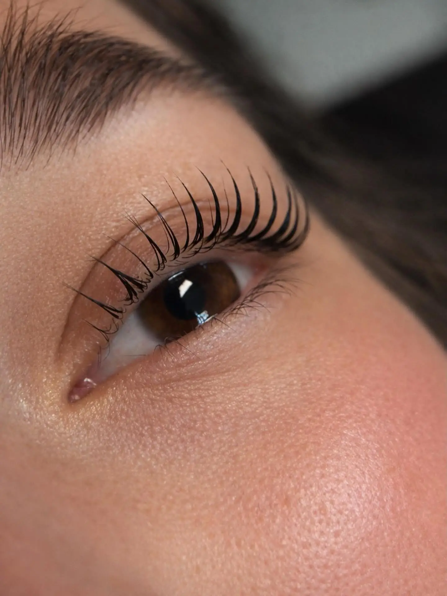 Service: Eye Treatments